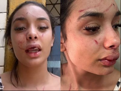 Mulher agredida por Bia Miranda anuncia medidas judiciais contra ataques na internet