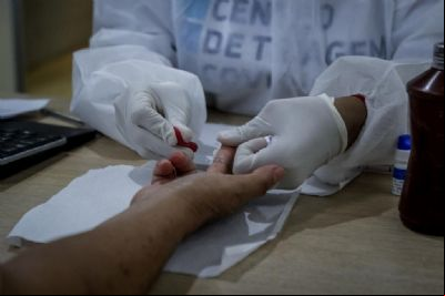 Governo de MT enviou 93,2 mil testes r